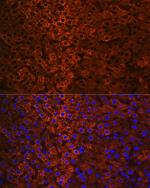 CES1 Antibody in Immunohistochemistry (Paraffin) (IHC (P))