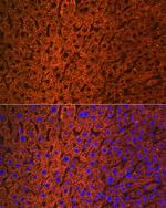 CES1 Antibody in Immunohistochemistry (Paraffin) (IHC (P))