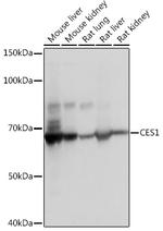 CES1 Antibody in Western Blot (WB)