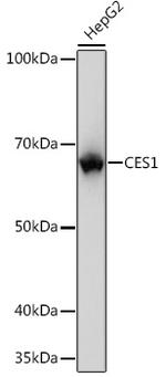 CES1 Antibody in Western Blot (WB)