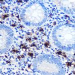 Mast Cell Chymase Antibody in Immunohistochemistry (Paraffin) (IHC (P))