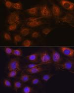 ARF6 Antibody in Immunocytochemistry (ICC/IF)