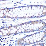 FGF2 Antibody in Immunohistochemistry (Paraffin) (IHC (P))