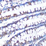 LOX Antibody in Immunohistochemistry (Paraffin) (IHC (P))