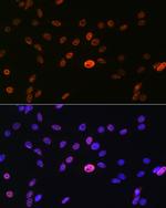 hnRNP A1 Antibody in Immunocytochemistry (ICC/IF)