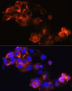 Glypican 3 Antibody in Immunocytochemistry (ICC/IF)