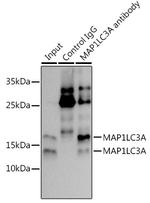 LC3A Antibody in Immunoprecipitation (IP)