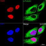 TOP1 Antibody in Immunocytochemistry (ICC/IF)