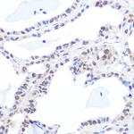 TOP1 Antibody in Immunohistochemistry (Paraffin) (IHC (P))