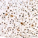 PCNA Antibody in Immunohistochemistry (Paraffin) (IHC (P))