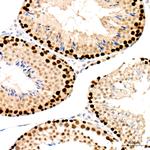 PCNA Antibody in Immunohistochemistry (Paraffin) (IHC (P))