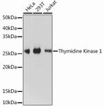 TK1 Antibody in Western Blot (WB)