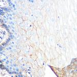 S100A10 Antibody in Immunohistochemistry (Paraffin) (IHC (P))