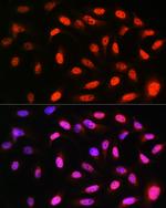 VCP Antibody in Immunocytochemistry (ICC/IF)