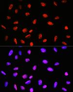 PABPN1 Antibody in Immunocytochemistry (ICC/IF)