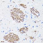 Amyloid Precursor Protein Antibody in Immunohistochemistry (Paraffin) (IHC (P))