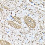 Amyloid Precursor Protein Antibody in Immunohistochemistry (Paraffin) (IHC (P))