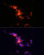 beta-3 Tubulin Antibody in Immunocytochemistry (ICC/IF)