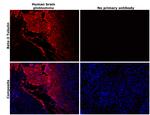 beta-3 Tubulin Antibody in Immunohistochemistry (Paraffin) (IHC (P))