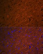 beta-3 Tubulin Antibody in Immunohistochemistry (Paraffin) (IHC (P))