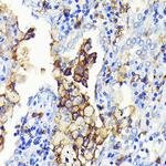 CD14 Antibody in Immunohistochemistry (Paraffin) (IHC (P))