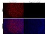 CD14 Antibody in Immunohistochemistry (Paraffin) (IHC (P))