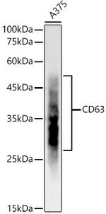 CD63 Antibody in Western Blot (WB)