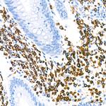 CD79a Antibody in Immunohistochemistry (Paraffin) (IHC (P))