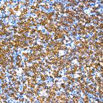 CD79a Antibody in Immunohistochemistry (Paraffin) (IHC (P))