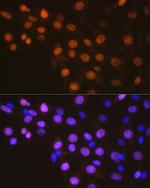 Cyclin A2 Antibody in Immunocytochemistry (ICC/IF)