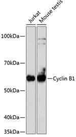 Cyclin B1 Antibody in Western Blot (WB)