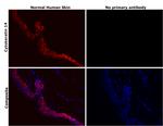 Cytokeratin 14 Antibody in Immunohistochemistry (Paraffin) (IHC (P))