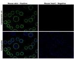 Cytokeratin 14 Antibody in Immunohistochemistry (Paraffin) (IHC (P))