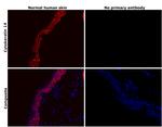 Cytokeratin 14 Antibody in Immunohistochemistry (Paraffin) (IHC (P))