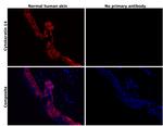 Cytokeratin 14 Antibody in Immunohistochemistry (Paraffin) (IHC (P))