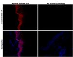 Cytokeratin 14 Antibody in Immunohistochemistry (Paraffin) (IHC (P))