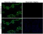 Cytokeratin 14 Antibody