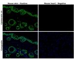 Cytokeratin 14 Antibody