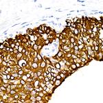 Cytokeratin 19 Antibody in Immunohistochemistry (Paraffin) (IHC (P))