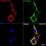 TRAIL-R2 (DR5) Antibody in Immunocytochemistry (ICC/IF)