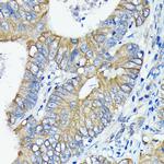 TRAIL-R2 (DR5) Antibody in Immunohistochemistry (Paraffin) (IHC (P))