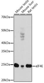 eIF4E Antibody in Western Blot (WB)