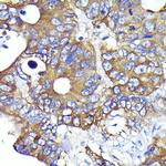 Ezrin Antibody in Immunohistochemistry (Paraffin) (IHC (P))