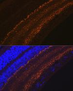 GAP43 Antibody in Immunohistochemistry (Paraffin) (IHC (P))