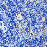 GRB2 Antibody in Immunohistochemistry (Paraffin) (IHC (P))