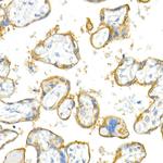 CD51 Antibody in Immunohistochemistry (Paraffin) (IHC (P))