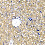 Leptin Receptor Antibody in Immunohistochemistry (Paraffin) (IHC (P))