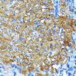 Leptin Receptor Antibody in Immunohistochemistry (Paraffin) (IHC (P))