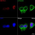 METTL3 Antibody in Immunocytochemistry (ICC/IF)