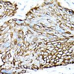 MUC1 Antibody in Immunohistochemistry (Paraffin) (IHC (P))